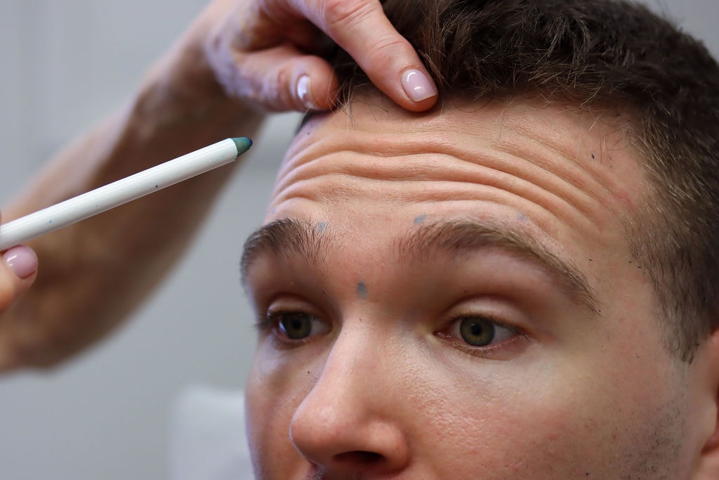 Dr Patti Piper identifying an anti-wrinkle injection point