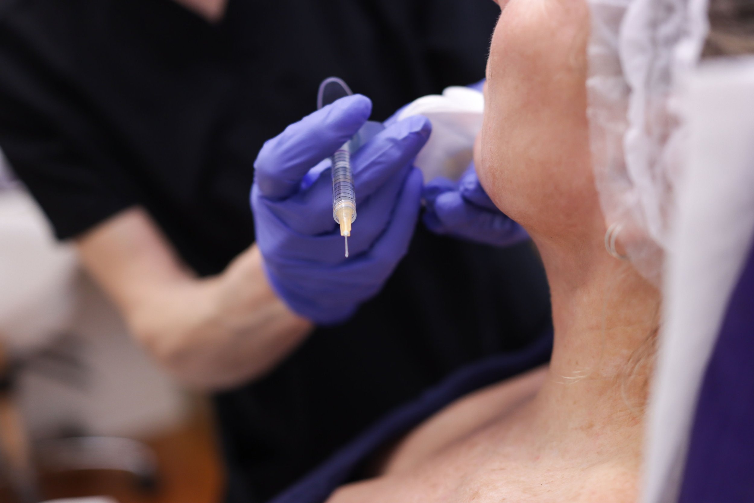 Dermal filler for early volume loss