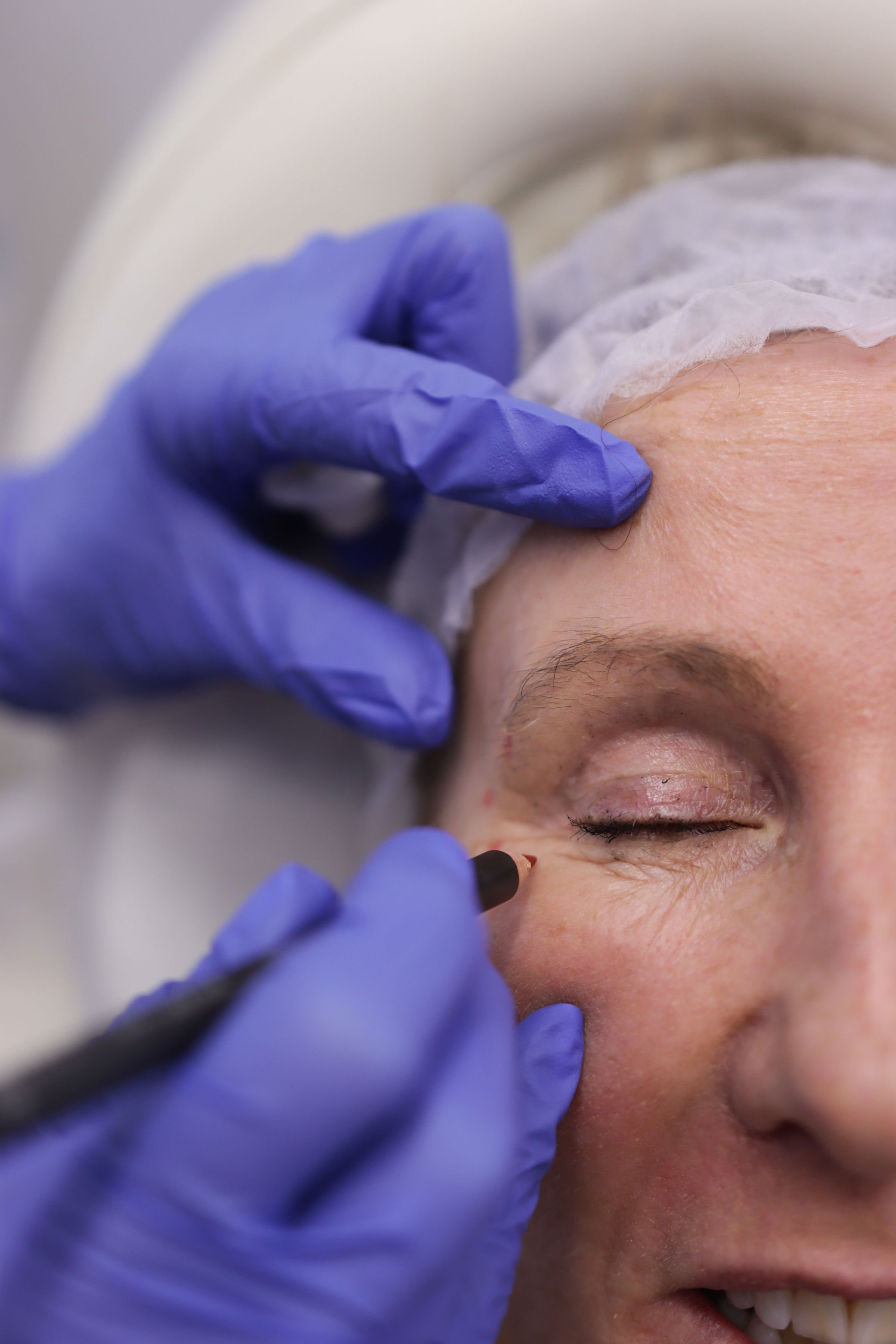 Early signs of facial ageing