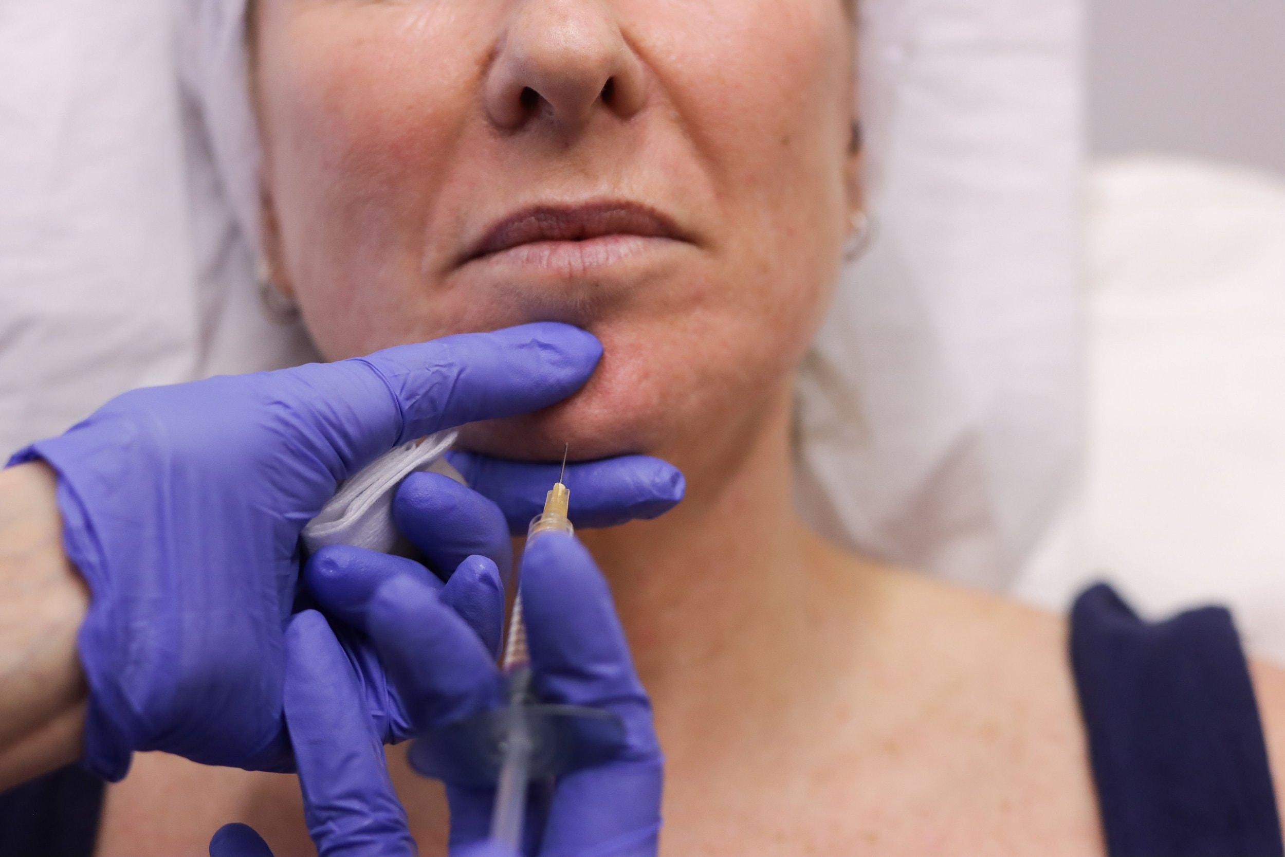 Dr Patti Piper preparing a dermal filler treatment