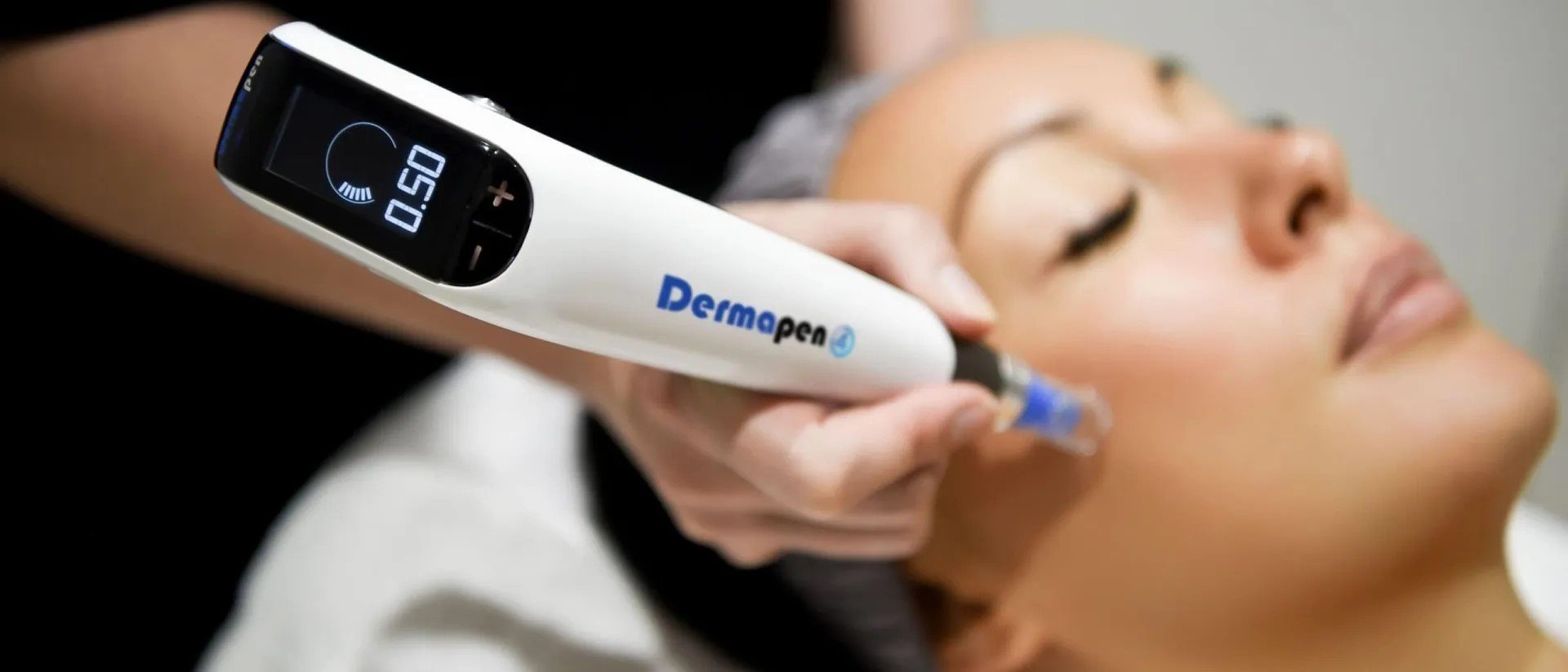 Medical dermal needling with the Dermapen 4