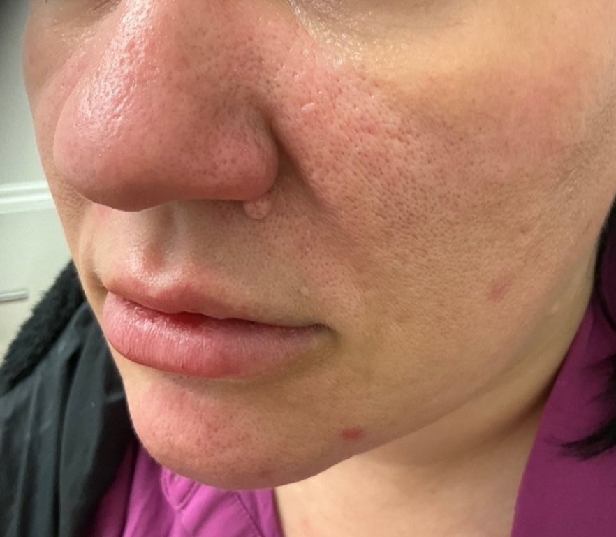 Dr Patti Piper examining a lesion